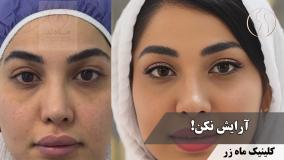 پوستت، اعتماد‌ به‌ نفست ( کلینیک زیبایی ماه زر )