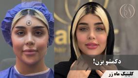 دکمشو زد جوون شد👨🏻‍🦳 ( کلینیک زیبایی ماه زر )