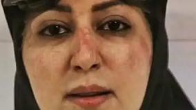 کلیپ روز پزشک مبارک برای وضعیت واتساپ | 1 شهریور