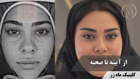 صحنه؛ داستان دختری با رویای بازیگری ( کلینیک زیبایی ماه زر )