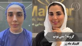 بدون آرایش هم می‌تونم زیبا باشم؟ 💄❌💔✨ ( کلینیک زیبایی ماه زر )