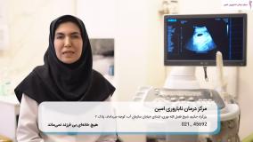 فریز تخمک بدون آسیب پرده بکارت