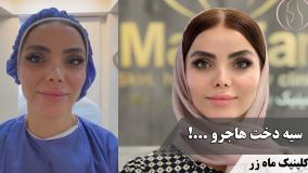 هاجر از همون نوجوونی یه چیزو خوب فهمیده بود! ( کلینیک زیبایی ماه زر )