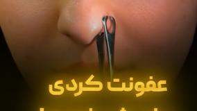 عفونت کردی بیا پیش خودم ⭕️