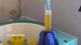حجم دهی و جوانسازی پوست با دستگاه پزشکی Bio Filler Maker