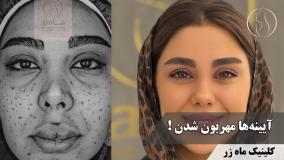👁️‍🗨️ آینه‌ها دوباره باهام مهربون شدن ( کلینیک زیبایی ماه زر )
