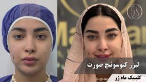  وقتی پوستت خوبه ✨ ( کلینیک زیبایی ماه زر )