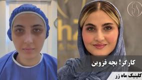 ⁨ 🧸✨ عروسکی عروسکی ✨🧸 ( کلینیک زیبایی ماه زر )
