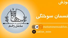 آموزش پانسمان سوختگی (مکمل زخم)