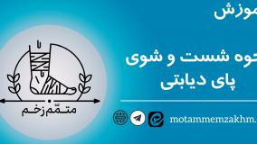 آموزش نحوه شستن زخم پای دیابتی (متمم_زخم)