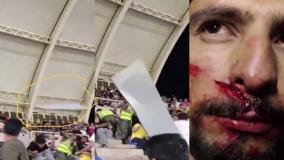 سقوط طلق سقف ورزشگاه پارس بر سر هوادار!