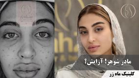 رازی پشت آرایش 🤫 ( کلینیک زیبایی ماه زر )