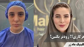 لمس ناتمام 🔥 ( کلینیک زیبایی ماه زر )