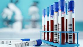 آزمایش های قبل از جراحی