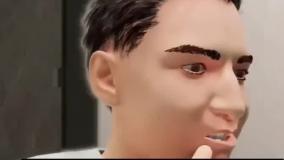 اگه فقط یه روز مسواک نزنی چی میشه؟ _ کلینیک نوتاش