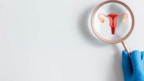 درمان زگیل تناسلی: