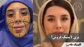 😍 تو هم دلت می‌خواد؟ ( کلینیک زیبایی ماه زر )