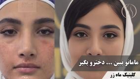 ✨ راز صورت صاف مامانم ✨ ( کلینیک زیبایی ماه زر )