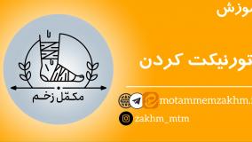 آموزش تورنیکت کردن (مکمل زخم)