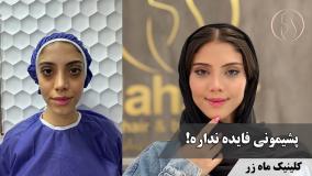 رفت که رفت، اولش داغون شدم ( کلینیک زیبایی ماه زر )