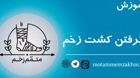 آموزش نحوه گرفتن کشت زخم (متمم_زخم)