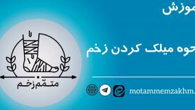 آموزش نحوه میلک کردن زخم (متمم_زخم)