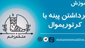 آموزش برداشتن پینه با کراتوریموال(متمم_زخم)