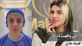 🤔 می‌خوای بدونی چی شد؟ ( کلینیک زیبایی ماه زر )