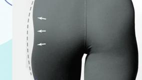 مطب زیبایی آنابلا