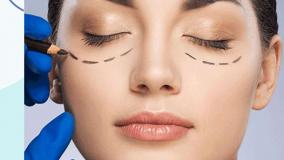 رفع افتادگی پلک بلفاروپلاستی