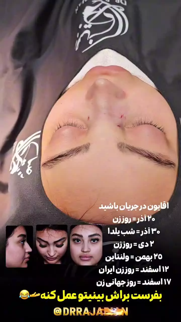 جراح پلاستیک و زیبایی رتبه اول بورد فوق تخصص، دکتر سعید رجبیان