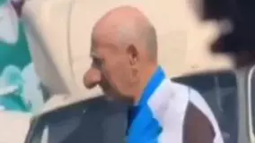 بینی بزرگ یک شهروند روسی: سوژه داغ شبکه‌های اجتماعی پس از تصادف!