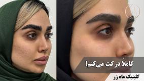 کاملاً درکت می‌کنم! ( کلینیک ماه زر - دکتر میثم ضرغامی )