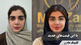 با این قیمت‌های جدید ( کلینیک ماه زر - دکتر میثم ضرغامی )