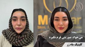 دریا می‌خواد صورتش فرم بگیره! ( کلینیک ماه زر - دکتر میثم ضرغامی )