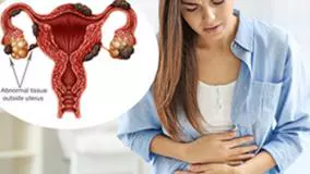 علت برآمدگی پایین شکم خانم ها و راه حلش چیست؟