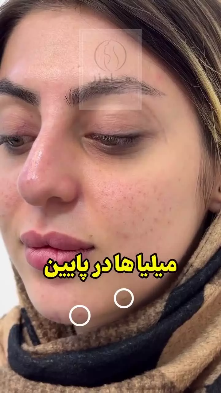 همیشه باید حواسمون به خودمون باشه! ( کلینیک ماه زر - دکتر میثم ضرغامی )