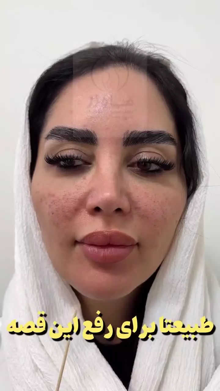 خجالت می‌کشیم ...! ( کلینیک ماه زر - دکتر میثم ضرغامی )