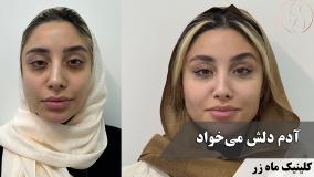 آدم دلش می‌خواد! ( کلینیک ماه زر - دکتر میثم ضرغامی )