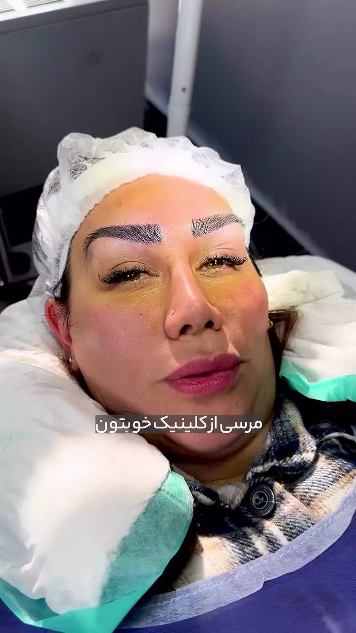 رضایت کافی از کاشت ابرو با آرامش خاطر در کلینیک آفرینش