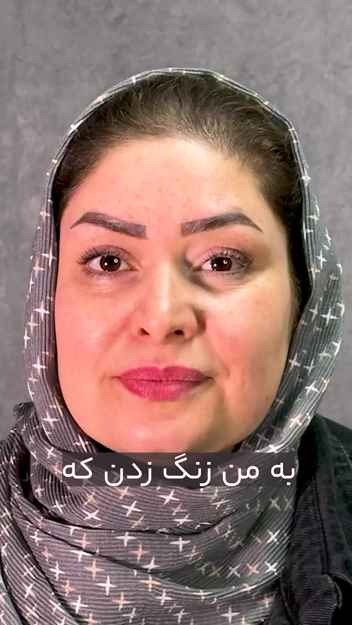 رضایتمندی زیباجو از کاشت ابرو در کلینیک آفرینش