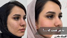 یه نفر هست که ...! ( کلینیک ماه زر - دکتر میثم ضرغامی )