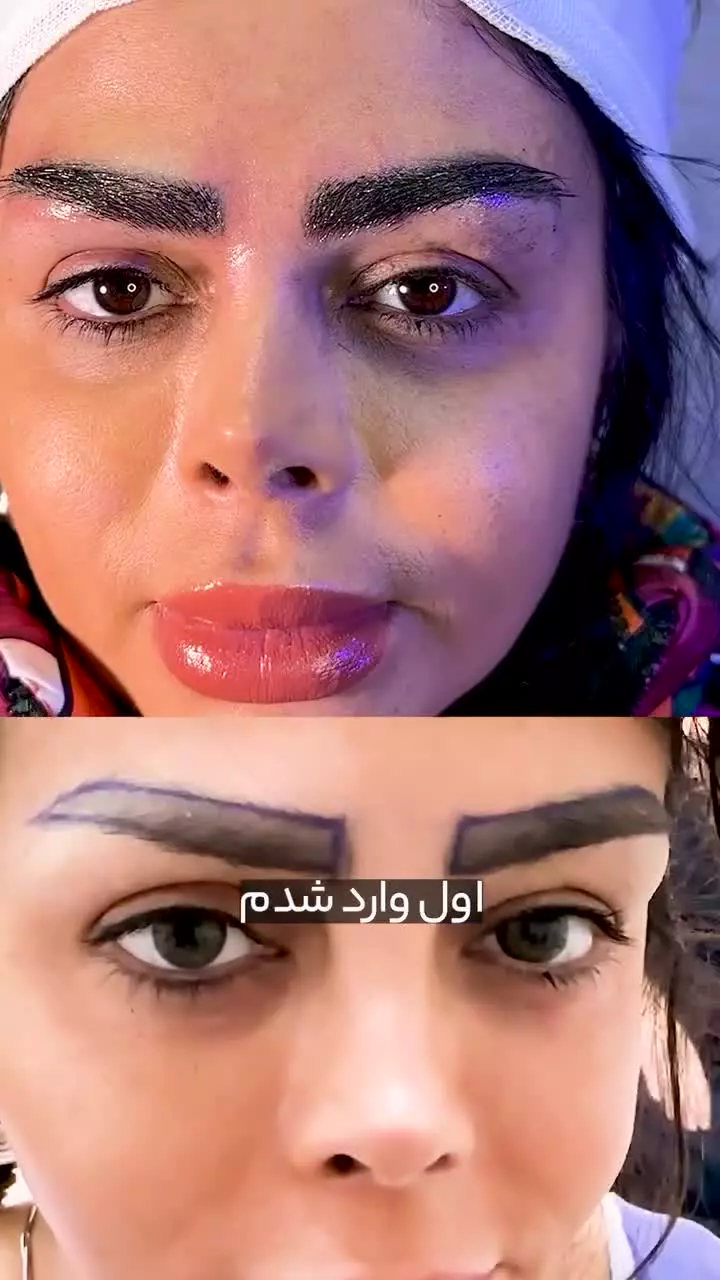 رضایت زیباجو از کاشت ابرو در کلینیک آفرینش