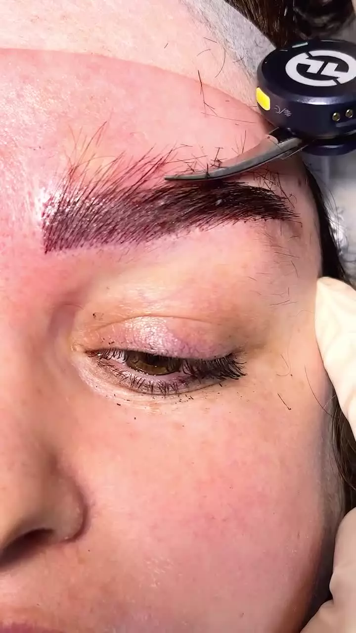 قیچی کردن ابرو بعد از کاشت ابرو در کلینیک آفرینش