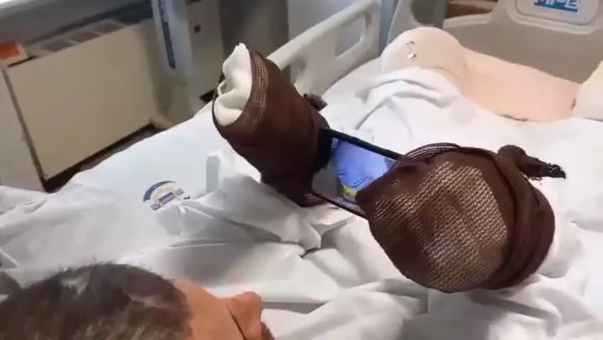 پای لانچر موشک خورده  هر دو دست و هر دو پایش قطع شده. فقط ۲۲ سال سن دارد.